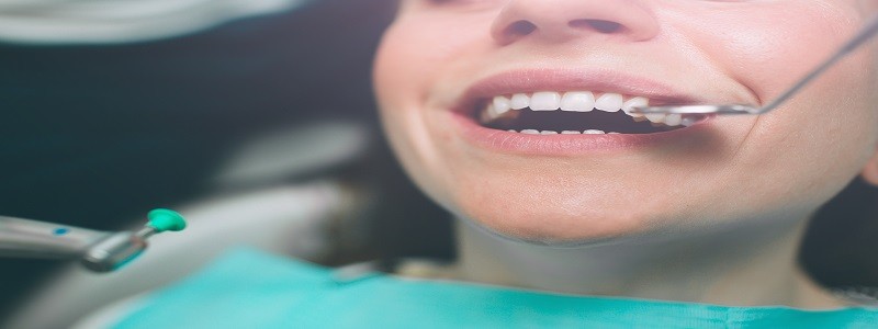 ציפוי חרסינה לשיניים בשיטה מיוחדת